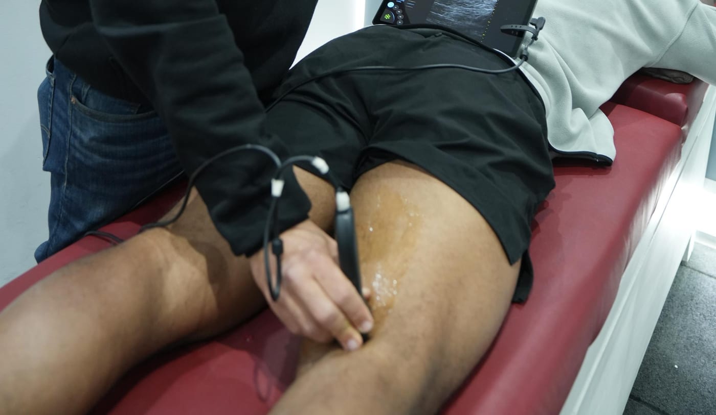 Ultrasound-guided treatment in session